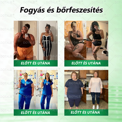 🎁 Már csak 5 doboz maradt! Most további 50% kedvezményt biztosítunk Önnek!  Érje el egészségesebb és fittebb önmagát.  Ne hagyja ki ezt a lehetőséget, mert lehet, hogy erre az ajánlatra csak jövőre lesz újra lehetőség.